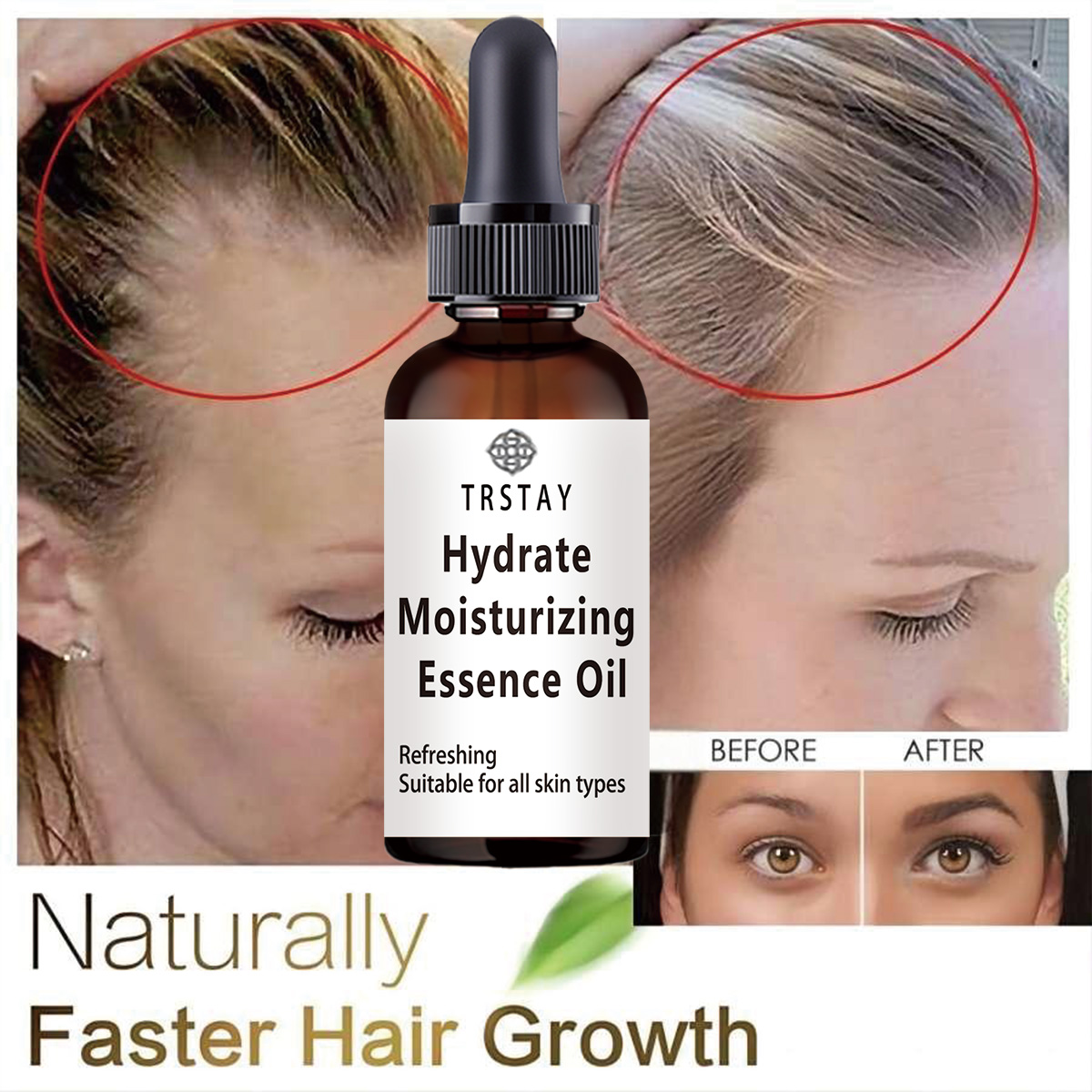 Coconut Oil Pull - Yeni Hint Yağı Saç Büyüme Uçucu