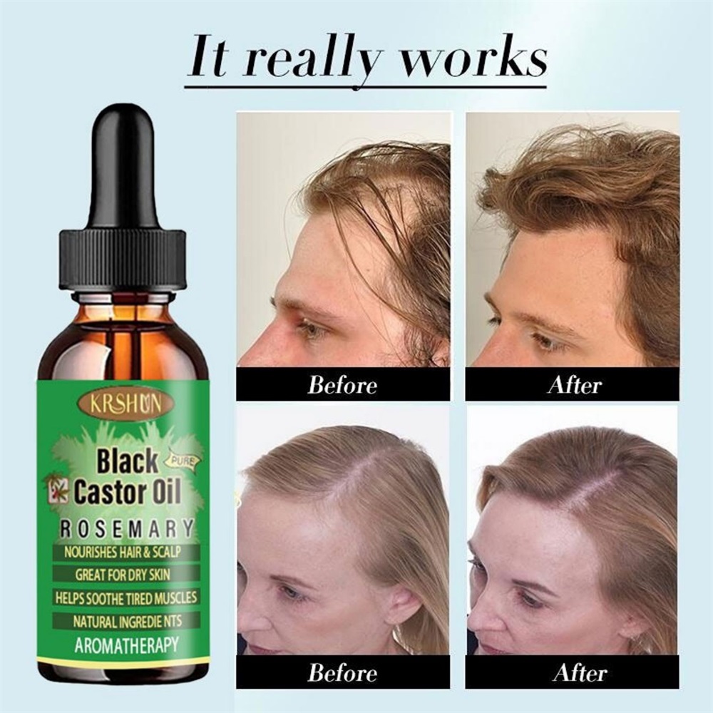 Coconut Oil Pull - Siyah hint yağı besler saç büyüme