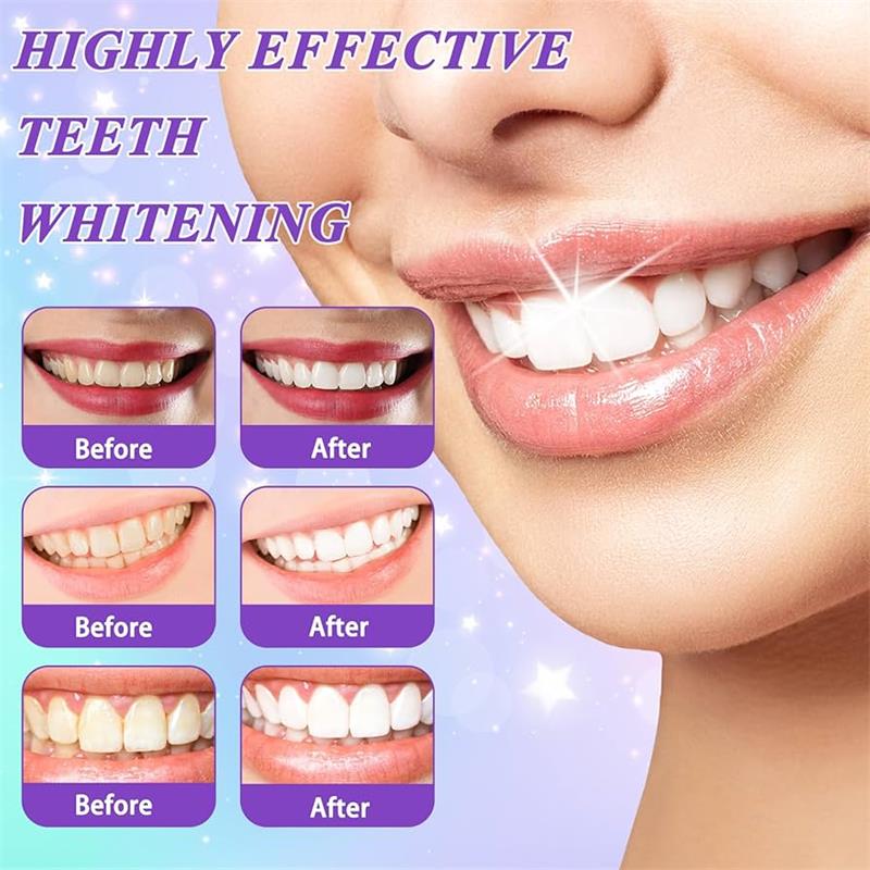 9D Mor Diş Beyazlatıcı Diş Mac - Remineralizing Toothpaste incelemesi ve fiyatı