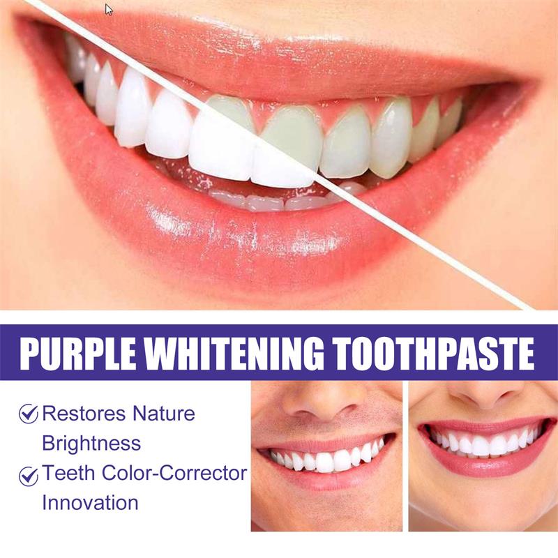 9D Mor Diş Beyazlatıcı Diş Mac - Remineralizing Toothpaste incelemesi ve fiyatı
