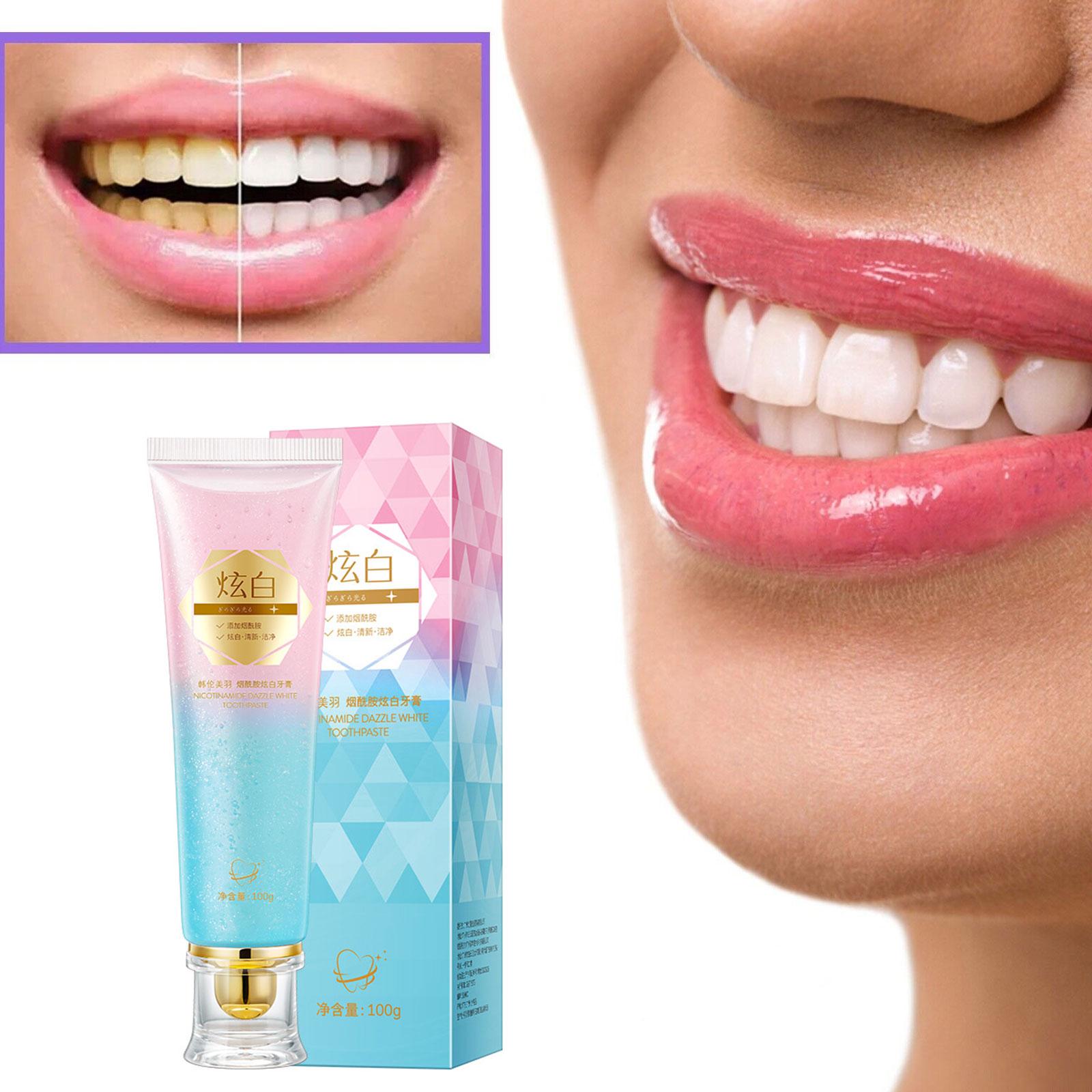 Niasinamid Beyazlatıcı Diş Mac - Teeth Whitening Treatment incelemesi ve fiyatı