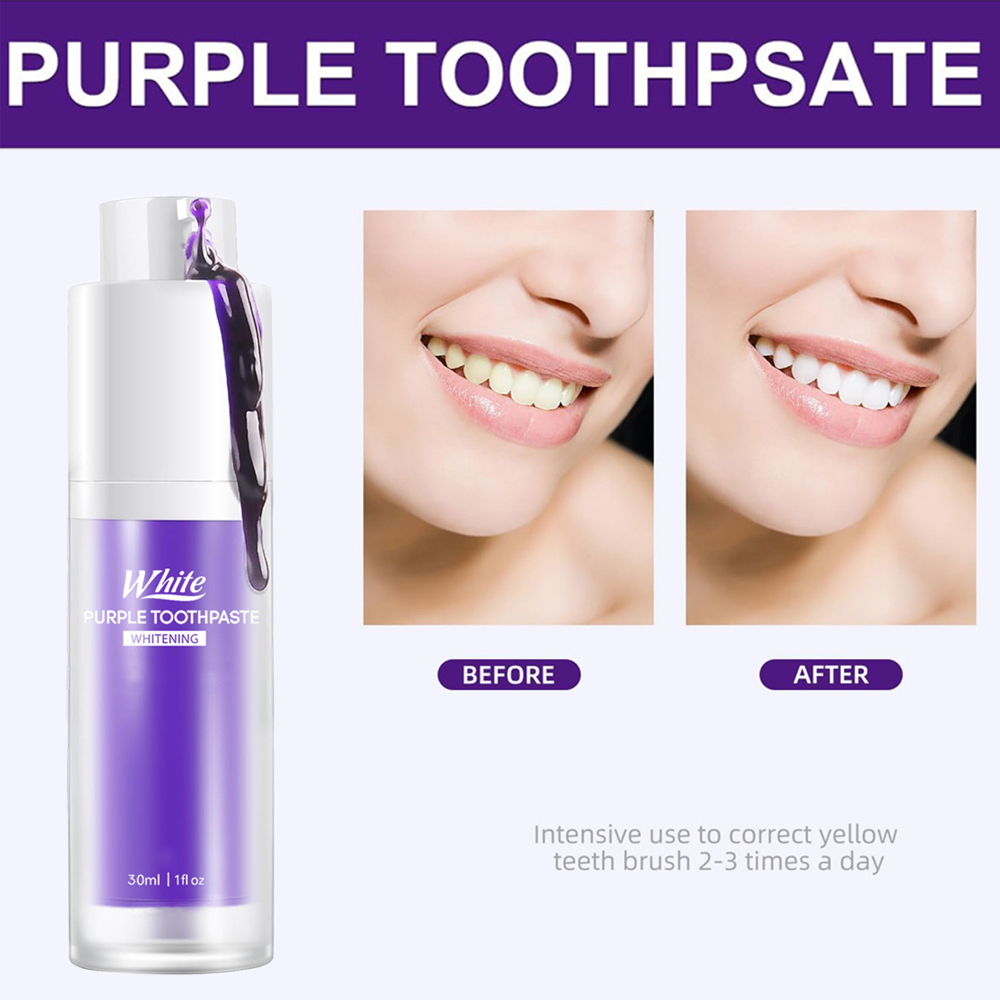 Mor Beyazlatıcı Diş Macunu 30m - Teeth Whitening Treatment incelemesi ve fiyatı