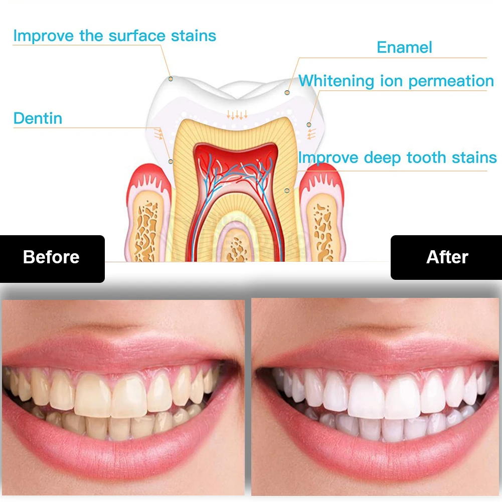 Diş Diş Beyazlatma Kiti Mini 1 - Teeth Whitening Flash incelemesi ve fiyatı