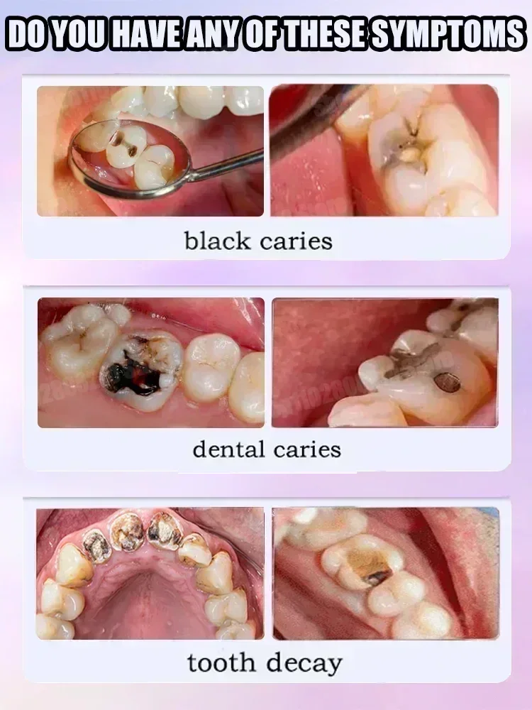Diğer Diş Temizleme Ürünleri D - Teeth Whitening Treatment incelemesi ve fiyatı